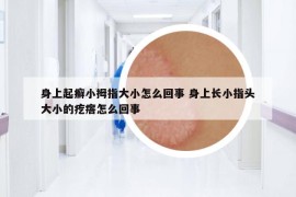 身上起癬小拇指大小怎么回事 身上長(zhǎng)小指頭大小的疙瘩怎么回事