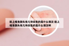 臉上嘴角額頭有幾塊白色的是什么情況 臉上嘴角額頭有幾塊白色的是什么情況啊