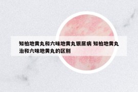 知柏地黃丸和六味地黃丸銀屑病 知柏地黃丸治和六味地黃丸的區(qū)別