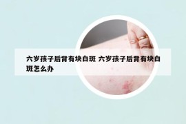 六歲孩子后背有塊白斑 六歲孩子后背有塊白斑怎么辦
