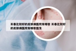 長春比較好的皮膚病醫(yī)院有哪些 長春比較好的皮膚病醫(yī)院有哪些醫(yī)生