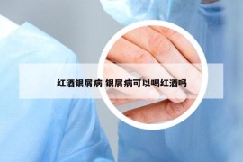 紅酒銀屑病 銀屑病可以喝紅酒嗎