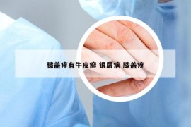 膝蓋疼有牛皮癬 銀屑病 膝蓋疼