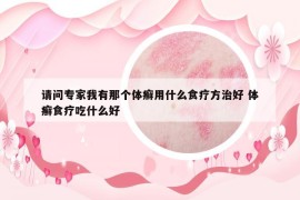 請問專家我有那個體癬用什么食療方治好 體癬食療吃什么好