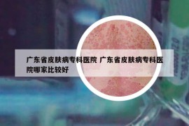 廣東省皮膚病?？漆t(yī)院 廣東省皮膚病?？漆t(yī)院哪家比較好
