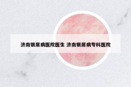 濟南銀屑病醫(yī)院醫(yī)生 濟南銀屑病?？漆t(yī)院