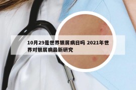 10月29是世界銀屑病日嗎 2021年世界對銀屑病最新研究