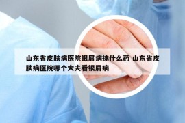 山東省皮膚病醫(yī)院銀屑病抹什么藥 山東省皮膚病醫(yī)院哪個(gè)大夫看銀屑病