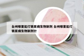 臺州哪里能打銀屑病生物制劑 臺州哪里能打銀屑病生物制劑針