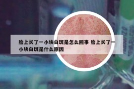 臉上長了一小塊白斑是怎么回事 臉上長了一小塊白斑是什么原因