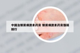中國(guó)治銀屑病激素藥膏 銀屑病激素藥膏強(qiáng)弱排行