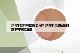 鄭州華住白斑醫(yī)院怎么樣 鄭州華住酒店集團旗下有哪些酒店