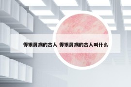 得銀屑病的古人 得銀屑病的古人叫什么