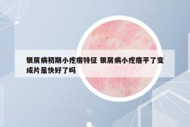 銀屑病初期小疙瘩特征 銀屑病小疙瘩平了變成片是快好了嗎
