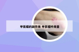 甲氨蝶的副作用 甲氨蝶吟用量