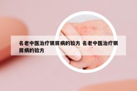 名老中醫(yī)治療銀屑病的驗方 名老中醫(yī)治療銀屑病的驗方