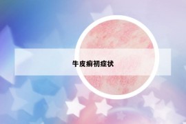 牛皮癬初癥狀