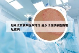 趙永江皮膚病醫(yī)院地址 趙永江皮膚病醫(yī)院地址查詢