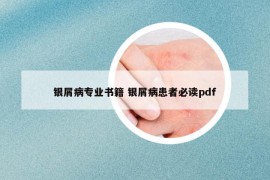 銀屑病專業(yè)書籍 銀屑病患者必讀pdf