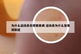 為什么運動員也得銀屑病 運動員為什么容易得新冠
