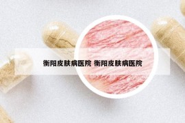 衡陽(yáng)皮膚病醫(yī)院 衡陽(yáng)皮膚病醫(yī)院