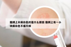 胳膊上長癬白色的是什么原因 胳膊上有一小塊癬白色不痛不癢