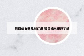 銀屑病有新品制遼嗎 銀屑病出新藥了嗎
