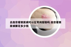 去南京看銀屑病可以在常州報銷嗎 南京看銀屑病要花多少錢