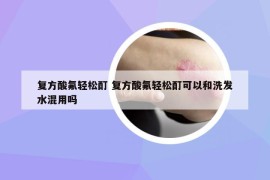 復方酸氟輕松酊 復方酸氟輕松酊可以和洗發(fā)水混用嗎