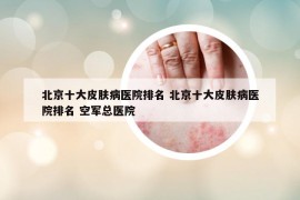 北京十大皮膚病醫(yī)院排名 北京十大皮膚病醫(yī)院排名 空軍總醫(yī)院
