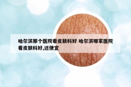 哈爾濱那個(gè)醫(yī)院看皮膚科好 哈爾濱哪家醫(yī)院看皮膚科好,還便宜