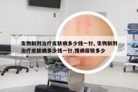 生物制劑治療皮膚病多少錢一針, 生物制劑治療皮膚病多少錢一針,慢病報銷多少