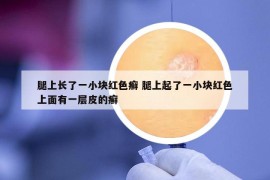 腿上長了一小塊紅色癬 腿上起了一小塊紅色上面有一層皮的癬