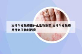 治療牛皮膚癬用什么生物劑藥 治療牛皮膚癬用什么生物劑藥膏
