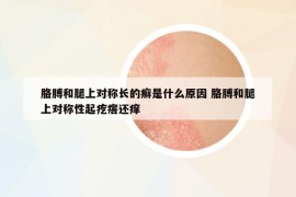 胳膊和腿上對稱長的癬是什么原因 胳膊和腿上對稱性起疙瘩還癢