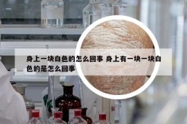 身上一塊白色的怎么回事 身上有一塊一塊白色的是怎么回事