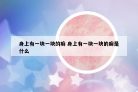 身上有一塊一塊的癬 身上有一塊一塊的癬是什么