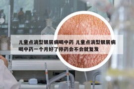 兒童點(diǎn)滴型銀屑病喝中藥 兒童點(diǎn)滴型銀屑病喝中藥一個(gè)月好了停藥會不會就復(fù)發(fā)