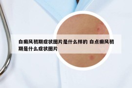 白癜風(fēng)初期癥狀圖片是什么樣的 白點(diǎn)癲風(fēng)初期是什么癥狀圖片