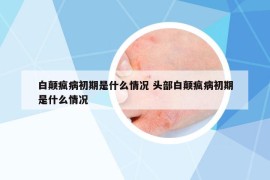 白顛瘋病初期是什么情況 頭部白顛瘋病初期是什么情況