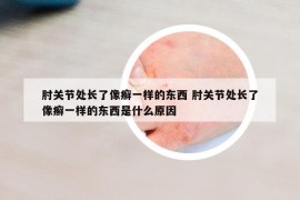 肘關節(jié)處長了像癬一樣的東西 肘關節(jié)處長了像癬一樣的東西是什么原因