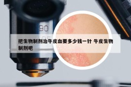 把生物制劑治牛皮血要多少錢一針 牛皮生物制劑吧