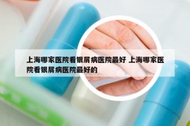 上海哪家醫(yī)院看銀屑病醫(yī)院最好 上海哪家醫(yī)院看銀屑病醫(yī)院最好的