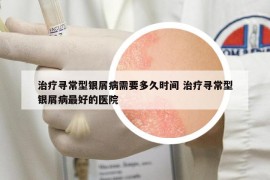 治療尋常型銀屑病需要多久時間 治療尋常型銀屑病最好的醫(yī)院