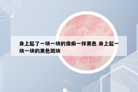 身上起了一塊一塊的像癬一樣黑色 身上起一塊一塊的黑色斑塊