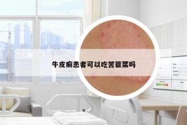 牛皮癬患者可以吃苦苣菜嗎