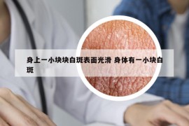 身上一小塊塊白斑表面光滑 身體有一小塊白斑