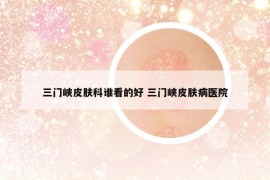 三門峽皮膚科誰看的好 三門峽皮膚病醫(yī)院