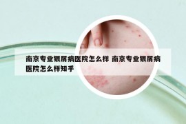 南京專業(yè)銀屑病醫(yī)院怎么樣 南京專業(yè)銀屑病醫(yī)院怎么樣知乎