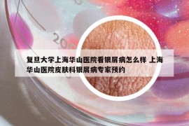 復(fù)旦大學(xué)上海華山醫(yī)院看銀屑病怎么樣 上海華山醫(yī)院皮膚科銀屑病專家預(yù)約